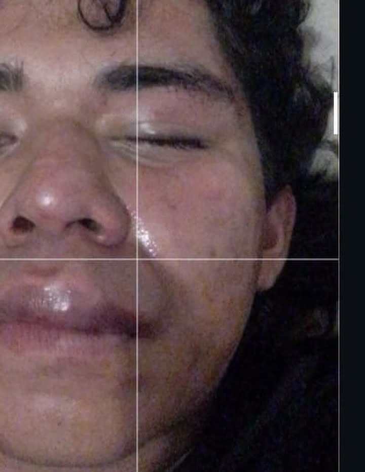 Brutal golpiza propinan a un periodista y buscador de personas desaparecidas en la CDMX