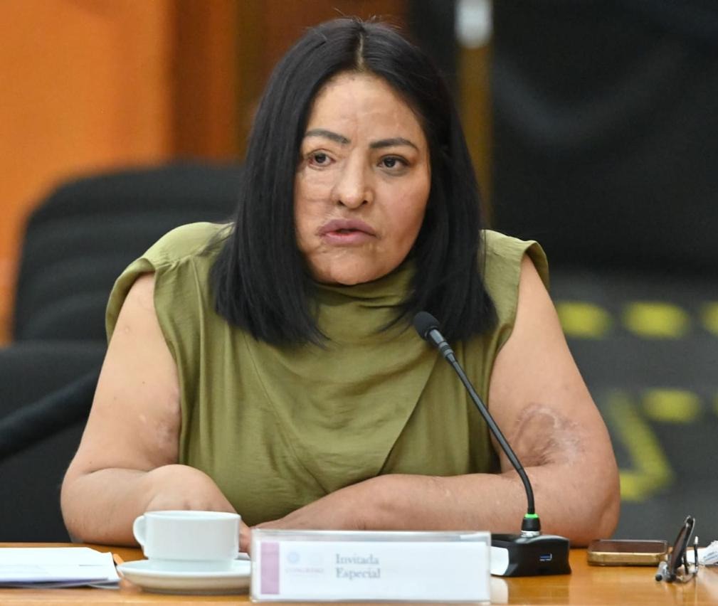 incompleta-ley-contra-violencia-acida-en-el-edomex-diputados-excluyeron-propuestas-de-victimas